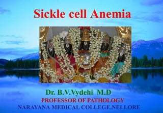 Dr. B.V.Vydehi M.D
PROFESSOR OF PATHOLOGY
NARAYANA MEDICAL COLLEGE,NELLORE
Sickle cell Anemia
 