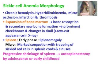 • Chronic hemolysis, Hyperbilirubinemia, microvascular
occlusion, infarction & thrombosis
• Expansion of bone marrow → bone resorption
& secondarynew bone formation → prominent
cheekbones& changesin skull (Crew-cut
appearancein X-ray)
• Spleen : Early phase : Splenomegaly
Micro : Marked congestion with trapping of
sickled red cells in splenic cords & sinuses
Progressive shrinkage of spleen → autosplenectomy
by adolescence or early childhood
Sickle cell Anemia Morphology
 
