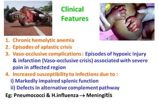 1. Chronic hemolytic anemia
2. Episodes of aplastic crisis
3. Vaso-occlusive complications: Episodes of hypoxic injury
& infarction (Vaso-occlusive crisis) associated with severe
pain in affected region
4. Increased susceptibilityto infections due to :
i) Markedly impaired splenic function
ii) Defects in alternative complementpathway
Eg: Pneumococci & H.influenza → Meningitis
Clinical
Features
 