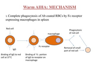 Comprehensive Overview of Sickle Cell Disease and Immune Hemolytic ...