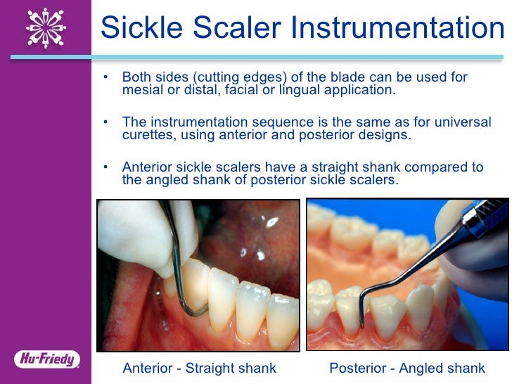 Sickle Scalers Clinical Application Guide