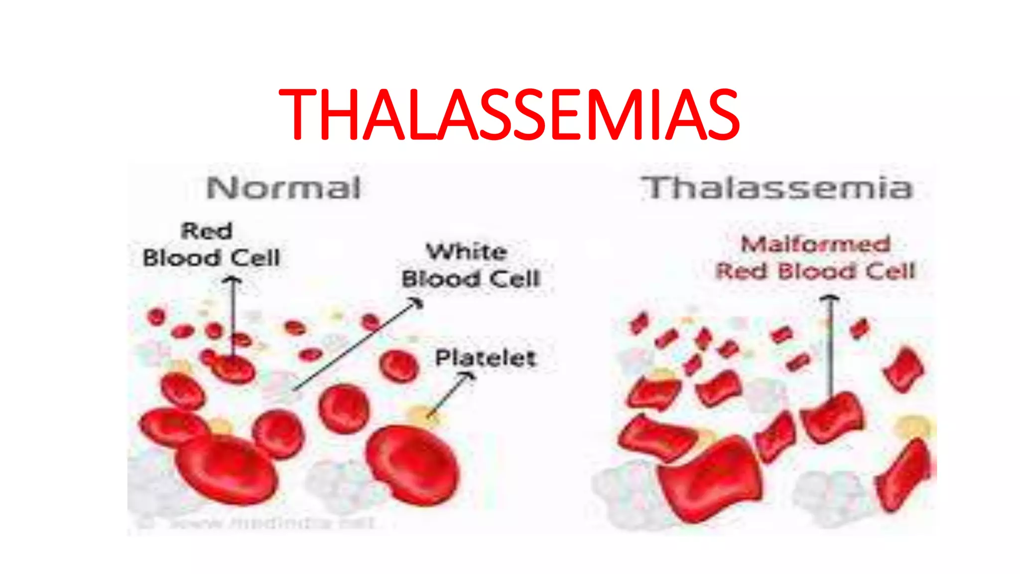Sickle cell Anemia & thalassemia | PPTX
