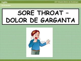 I.E.P «Nuestra Señora de Guadalupe»Inglés
Sicknesses
SORE THROAT –
DOLOR DE GARGANTA