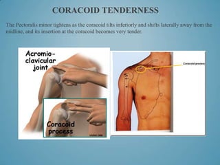 S.I.C.K. Scapula with Clavicle Fractures Case Study Presentation (2013 ...