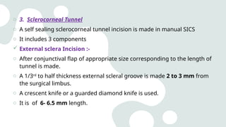 Small incision cataract surgery in Modern era | PPTX