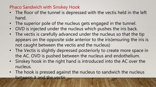 Phaco Sandwich with Sinskey Hook
• The floor of the tunnel is depressed with the vectis held in the left
hand.
• The superior pole of the nucleus gets engaged in the tunnel.
• OVD is injected under the nucleus which pushes the iris back.
• The vectis is carefully advanced under the nucleus so that the tip
appears on the opposite side anterior to the iris(ensuring the iris is
not caught between the vectis and the nucleus)
• The Vectis is slightly depressed posteriorly to create more space in
the AC. OVD is pushed between the nucleus and endothelium.
• Sinskey hook in the right hand is introduced into the AC over the
nucleus.
• The hook is pressed against the nucleus to sandwich the nucleus
between it and the vectis
 