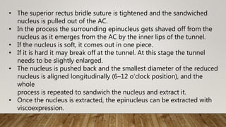 • The superior rectus bridle suture is tightened and the sandwiched
nucleus is pulled out of the AC.
• In the process the surrounding epinucleus gets shaved off from the
nucleus as it emerges from the AC by the inner lips of the tunnel.
• If the nucleus is soft, it comes out in one piece.
• If it is hard it may break off at the tunnel. At this stage the tunnel
needs to be slightly enlarged.
• The nucleus is pushed back and the smallest diameter of the reduced
nucleus is aligned longitudinally (6–12 o’clock position), and the
whole
process is repeated to sandwich the nucleus and extract it.
• Once the nucleus is extracted, the epinucleus can be extracted with
viscoexpression.
 