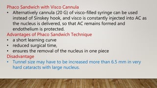 Phaco Sandwich with Visco Cannula
• Alternatively cannula (20 G) of visco-filled syringe can be used
instead of Sinskey hook, and visco is constantly injected into AC as
the nucleus is delivered, so that AC remains formed and
endothelium is protected.
Advantages of Phaco Sandwich Technique
• a short learning curve
• reduced surgical time,
• ensures the removal of the nucleus in one piece
Disadvantage
• Tunnel size may have to be increased more than 6.5 mm in very
hard cataracts with large nucleus.
 