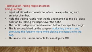 Technique of Trailing Haptic Insertion
Using Forceps
• Inject additional viscoelastic to inflate the capsular bag and
anterior chamber.
• Hold the trailing haptic near the tip and move it to the 3 o’ clock
position by folding the haptic over the optic.
• The haptic is depressed and released below the capsular margin
• This is accomplished by the surgeon abducting the arm and
pronating the forearm more while placing the haptic in to the
bag.
• This maneuver is more suitable for a multipiece IOL.
 