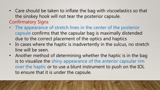 • Care should be taken to inflate the bag with viscoelastics so that
the sinskey hook will not tear the posterior capsule.
Confirmatory Signs
• The appearance of stretch lines in the center of the posterior
capsule confirms that the capsular bag is maximally distended
due to the correct placement of the optics and haptics
• In cases where the haptic is inadvertently in the sulcus, no stretch
line will be seen.
• Another method of determining whether the haptic is in the bag
is to visualize the shiny appearance of the anterior capsular rim
over the haptic or to use a blunt instrument to push on the IOL
to ensure that it is under the capsule.
 
