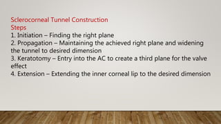 Sclerocorneal Tunnel Construction
Steps
1. Initiation – Finding the right plane
2. Propagation – Maintaining the achieved right plane and widening
the tunnel to desired dimension
3. Keratotomy – Entry into the AC to create a third plane for the valve
effect
4. Extension – Extending the inner corneal lip to the desired dimension
 