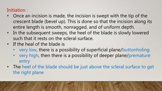 Initiation :
• Once an incision is made, the incision is swept with the tip of the
crescent blade (bevel up). This is done so that the incision along its
entire length is smooth, nonragged, and of uniform depth.
• In the subsequent sweeps, the heel of the blade is slowly lowered
such that it rests on the scleral surface.
• If the heal of the blade is
• very low, there is a possibility of superficial plane/buttonholing
• very high, then there is a possibility of deeper plane/premature
entry
• The heel of the blade should be just above the scleral surface to get
the right plane
 