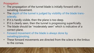 Propagation
• The propagation of the tunnel blade is initially forward with a
swiveling movement.
• The depth of the tunnel is judged by visibility of the blade trans-
sclerally.
• If it is hardly visible, then the plane is too deep.
• If it is clearly seen, then the tunnel is progressing superficially.
• The blade should be “moderately seen” which is indicative of a
correct plane.
• Forward movement of the blade is always done by
swiveling/pivoting.
• These forward movements are directed from the sclera to the limbus
to the cornea.
 
