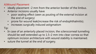 A)Wound Placement
• ideally placement -2 mm from the anterior border of the limbus.
• Anterior incisions usually have
• poor sealing effect (seen as pouting of the external incision at
the end of surgery)
• prone for wound leak(increase the risk of endophthalmitis).
• increases surgically induced astigmatism
Tip:
• In case of an anteriorly placed incision, the sclerocorneal tunneling
should be well extended up to 1.5–2 mm into clear cornea so that
optimum incision architecture with wound stability is maintained.
• suture the tunnel at the end of surgery.
 