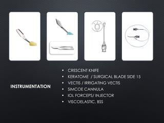 Iol Injector Instrument Drawing SICS vs ECCE: A paradigm shift in cataract surgery | PPTX