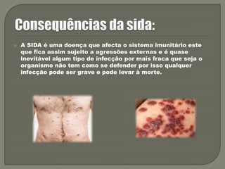 Consequências da sida:A SIDA é uma doença que afecta o sistema imunitário este que fica assim sujeito a agressões externas e é quase inevitável algum tipo de infecção por mais fraca que seja o organismo não tem como se defender por isso qualquer infecção pode ser grave e pode levar à morte.