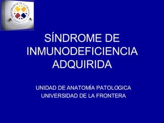 SÍNDROME DE INMUNODEFICIENCIA ADQUIRIDA UNIDAD DE ANATOMÍA PATOLOGICA UNIVERSIDAD DE LA FRONTERA 