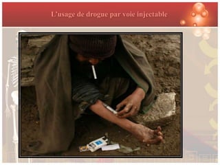 L’usage de drogue par voie injectable
 