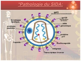 *Pathologie du SIDA:
 