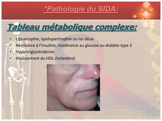 *Pathologie du SIDA:

Tableau métabolique complexe:
•   Lipoatrophie, lipohypertrophie ou les deux
•   Résistance à l’insuline, intolérance au glucose ou diabète type 2
•   Hypertriglycéridémie
•   Abaissement du HDL cholestérol
 
