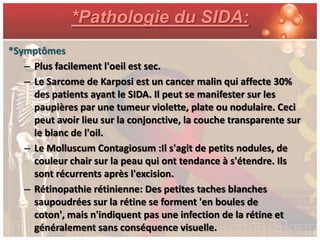 *Pathologie du SIDA:
*Symptômes
   – Plus facilement l'oeil est sec.
   – Le Sarcome de Karposi est un cancer malin qui affecte 30%
     des patients ayant le SIDA. Il peut se manifester sur les
     paupières par une tumeur violette, plate ou nodulaire. Ceci
     peut avoir lieu sur la conjonctive, la couche transparente sur
     le blanc de l'oil.
   – Le Molluscum Contagiosum :Il s'agit de petits nodules, de
     couleur chair sur la peau qui ont tendance à s'étendre. Ils
     sont récurrents après l'excision.
   – Rétinopathie rétinienne: Des petites taches blanches
     saupoudrées sur la rétine se forment 'en boules de
     coton', mais n'indiquent pas une infection de la rétine et
     généralement sans conséquence visuelle.
 