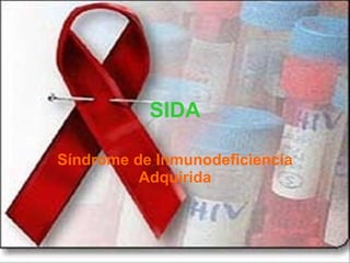 SIDA Síndrome de Inmunodeficiencia Adquirida 