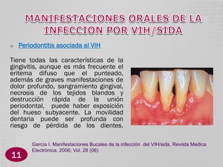 

Periodontitis asociada al VIH

Tiene todas las características de la
gingivitis, aunque es más frecuente el
eritema difuso que el punteado,
además de graves manifestaciones de
dolor profundo, sangramiento gingival,
necrosis de los tejidos blandos y
destrucción rápida de la unión
periodontal, puede haber exposición
del hueso subyacente. La movilidad
dentaria puede ser profunda con
riesgo de pérdida de los dientes.

11

García I. Manifestaciones Bucales de la infección del VIH/sida. Revista Medica
Electrónica. 2006; Vol. 28 (06)

 