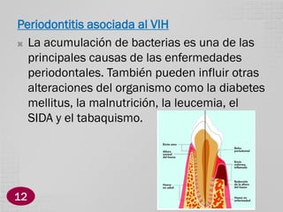 Periodontitis asociada al VIH
 La acumulación de bacterias es una de las
principales causas de las enfermedades
periodontales. También pueden influir otras
alteraciones del organismo como la diabetes
mellitus, la malnutrición, la leucemia, el
SIDA y el tabaquismo.

12

 