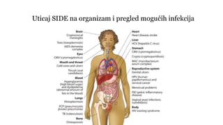 Uticaj SIDE na organizam i pregled mogućih infekcija
 