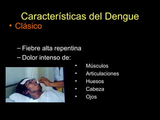 Características del Dengue Clásico Fiebre alta repentina Dolor intenso de: Músculos  Articulaciones Huesos Cabeza Ojos 