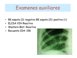 Examenes auxiliares
• BK esputo (1): negativo BK esputo (2): positivo (+)
• ELISA VIH Reactivo
• Western Blot: Reactivo
• Recuento CD4: 158
 