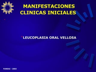 MANIFESTACIONES CLINICAS INICIALES   LEUCOPLASIA ORAL VELLOSA 