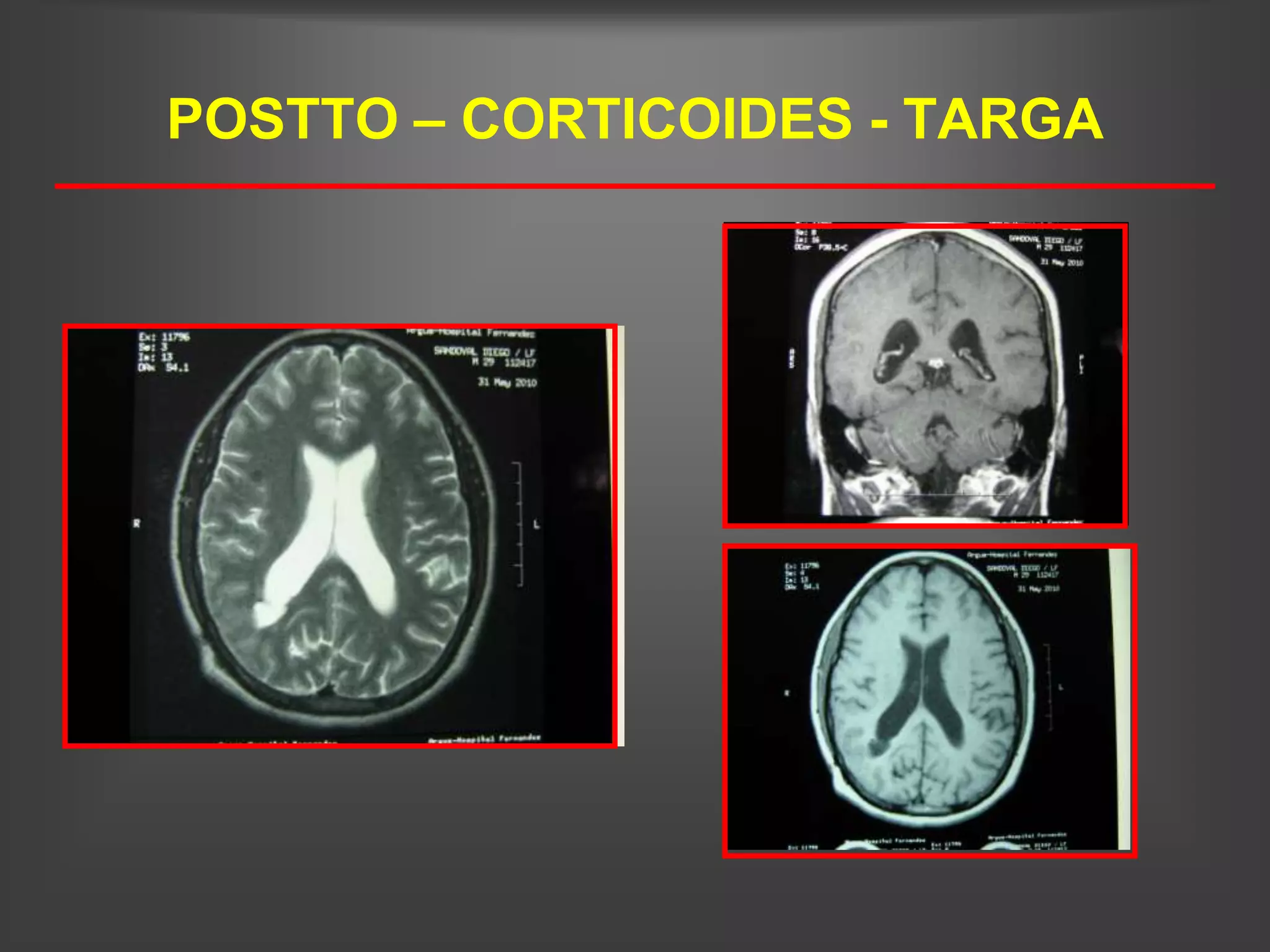POSTTO – CORTICOIDES - TARGA
 