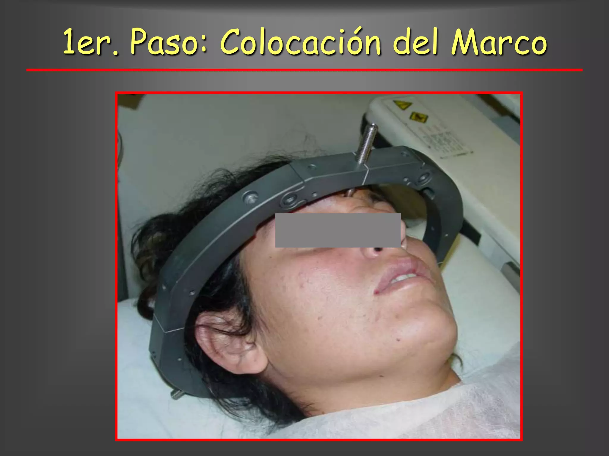 1er. Paso: Colocación del Marco
 