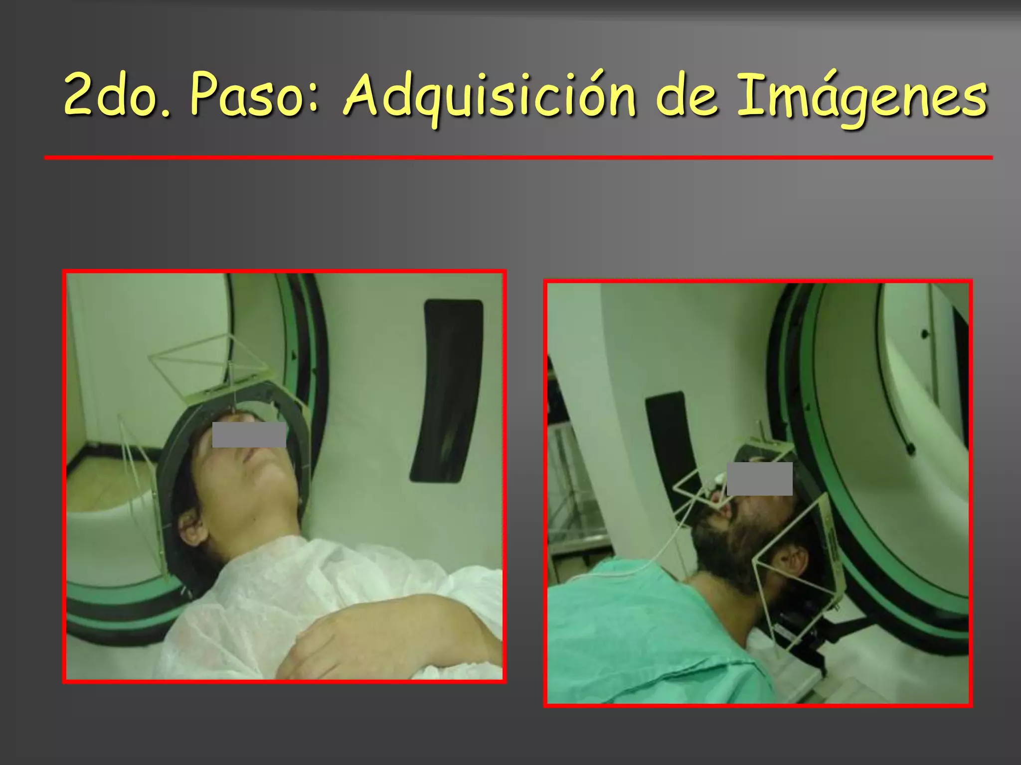 2do. Paso: Adquisición de Imágenes
 