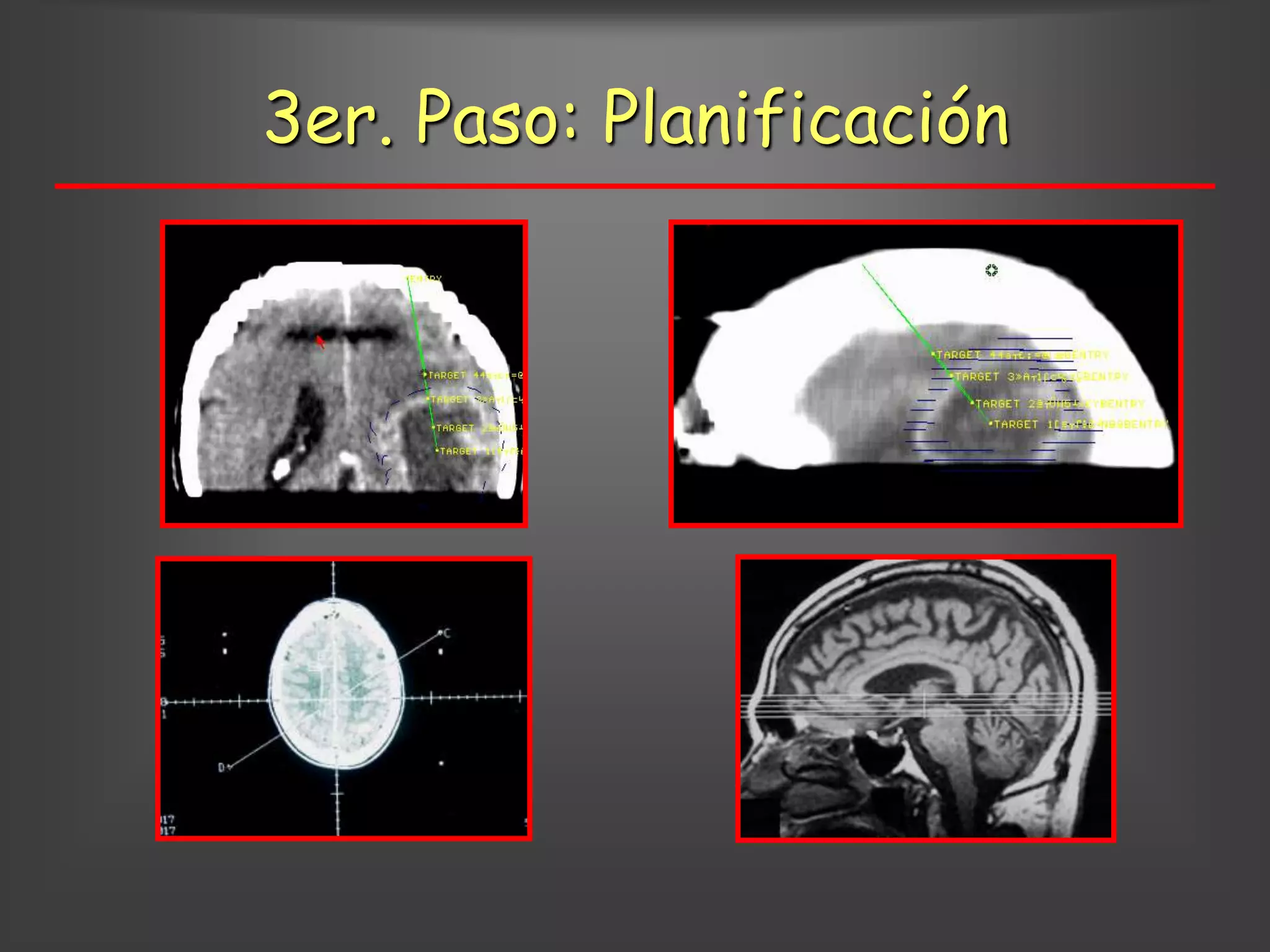 3er. Paso: Planificación
 