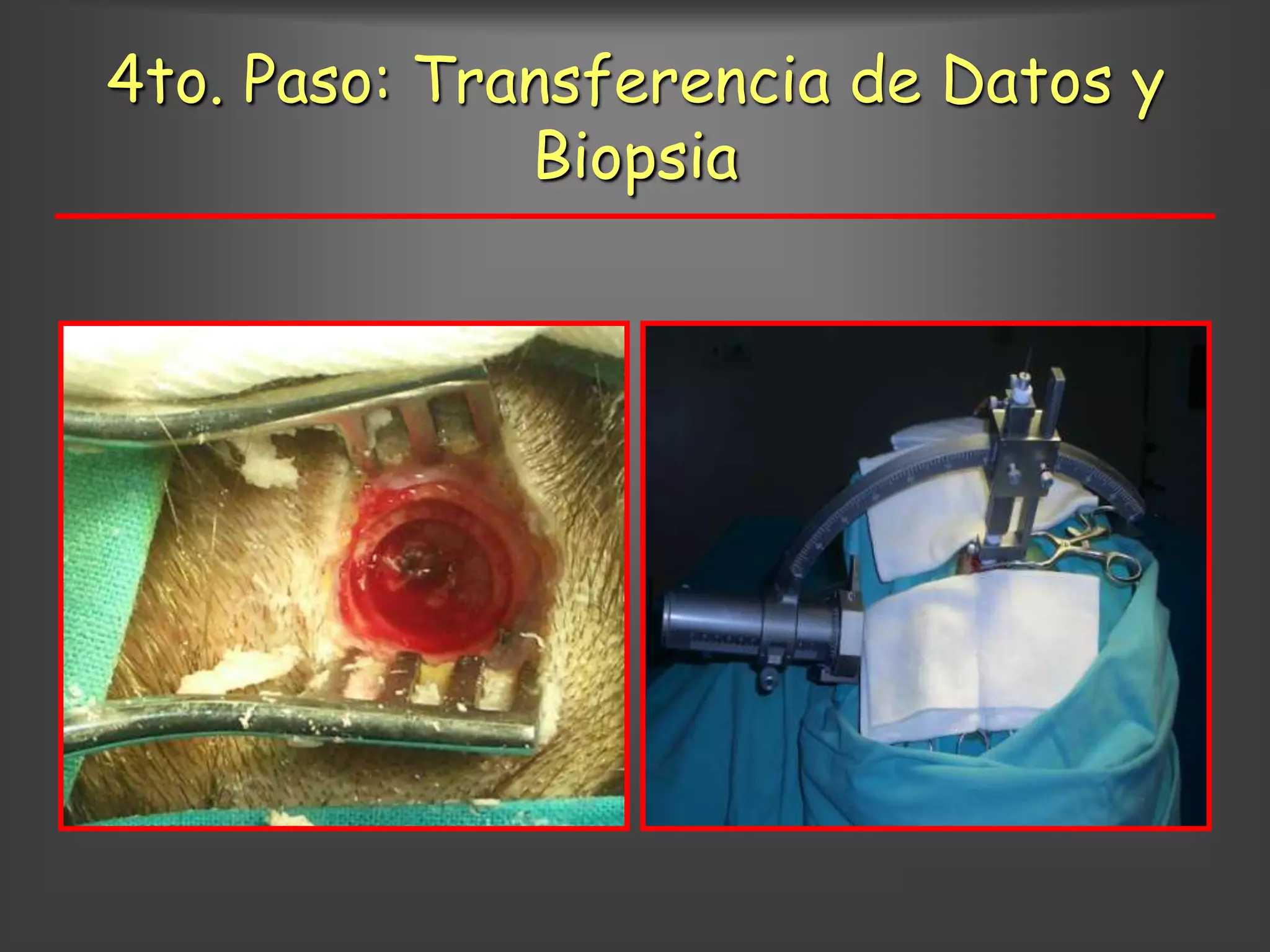 4to. Paso: Transferencia de Datos y
              Biopsia
 