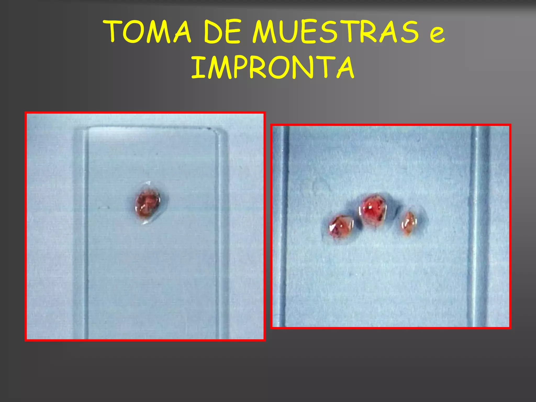 TOMA DE MUESTRAS e
    IMPRONTA
 