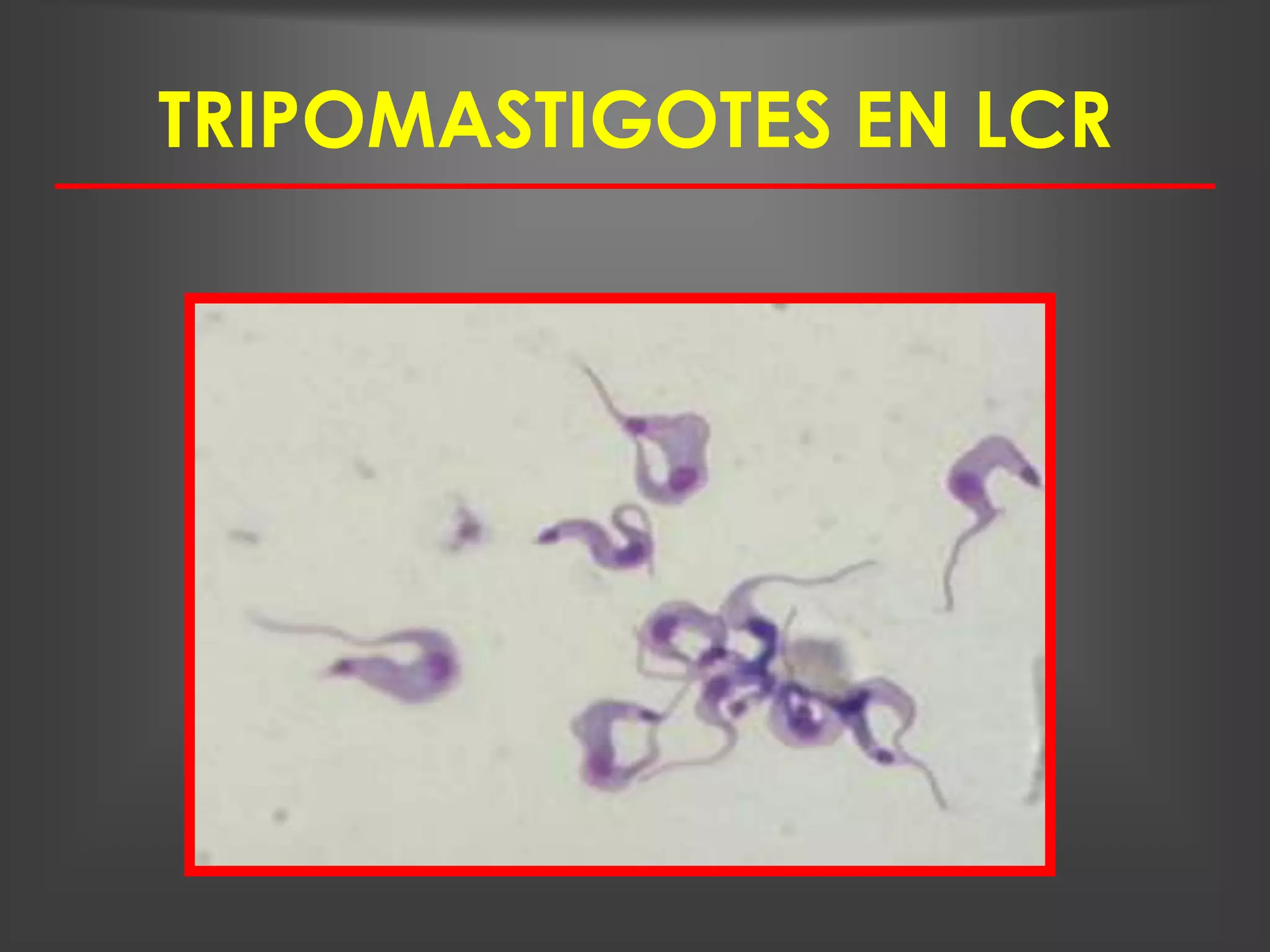 TRIPOMASTIGOTES EN LCR
 