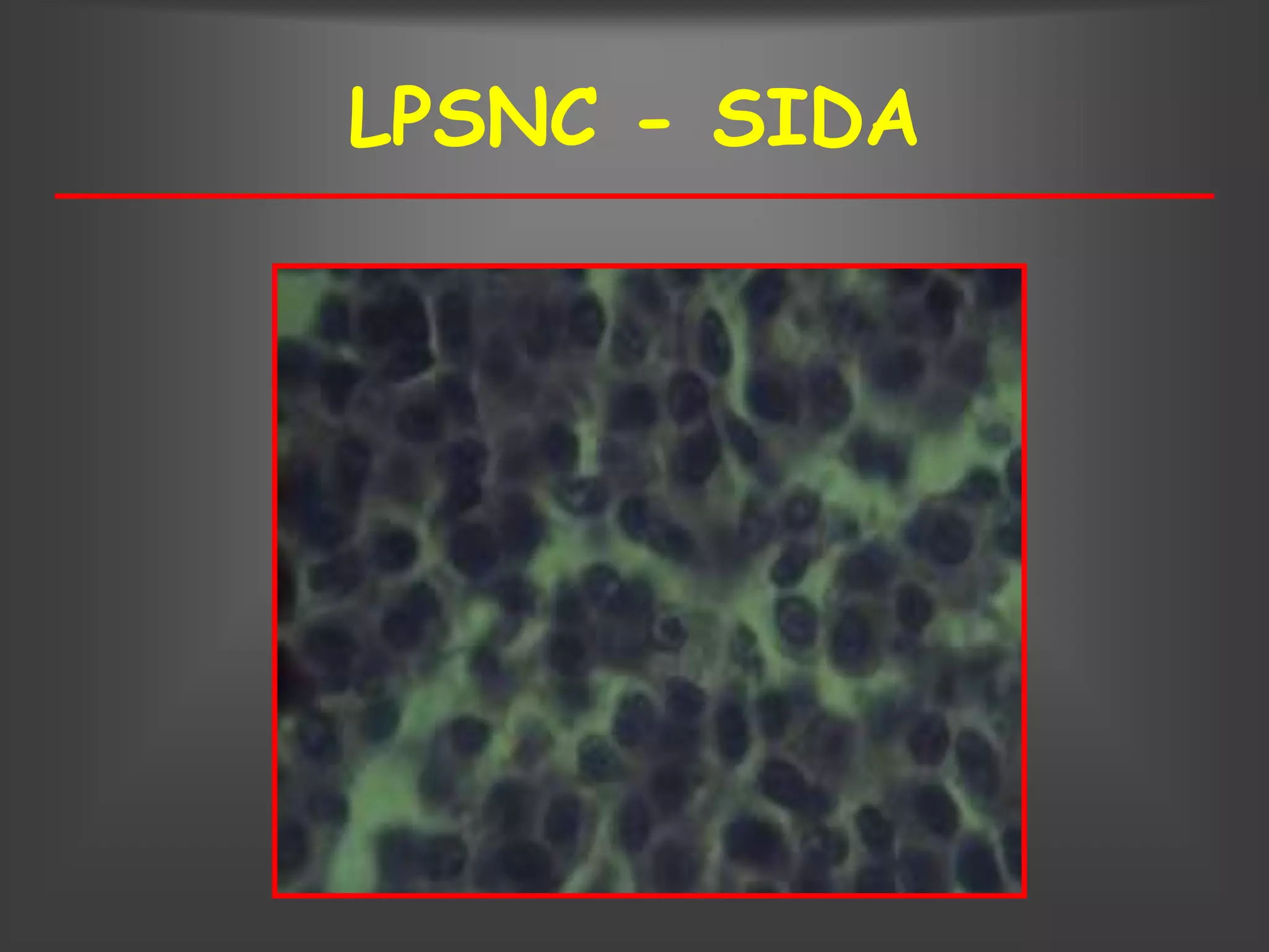LPSNC - SIDA
 