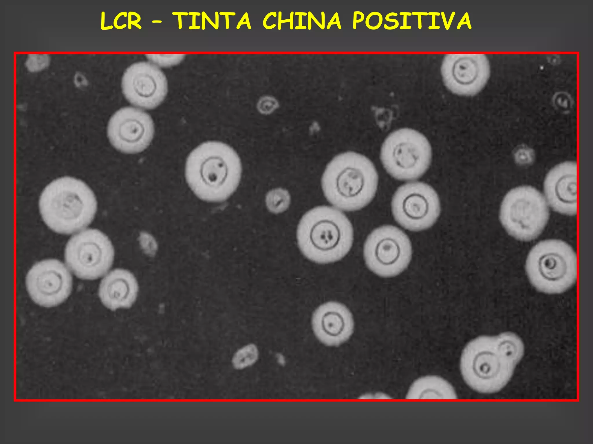 LCR – TINTA CHINA POSITIVA
 