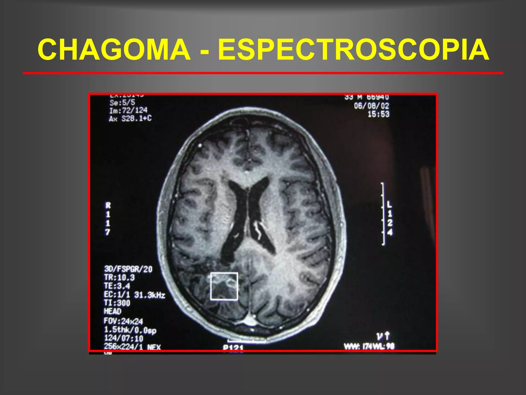 CHAGOMA - ESPECTROSCOPIA
 