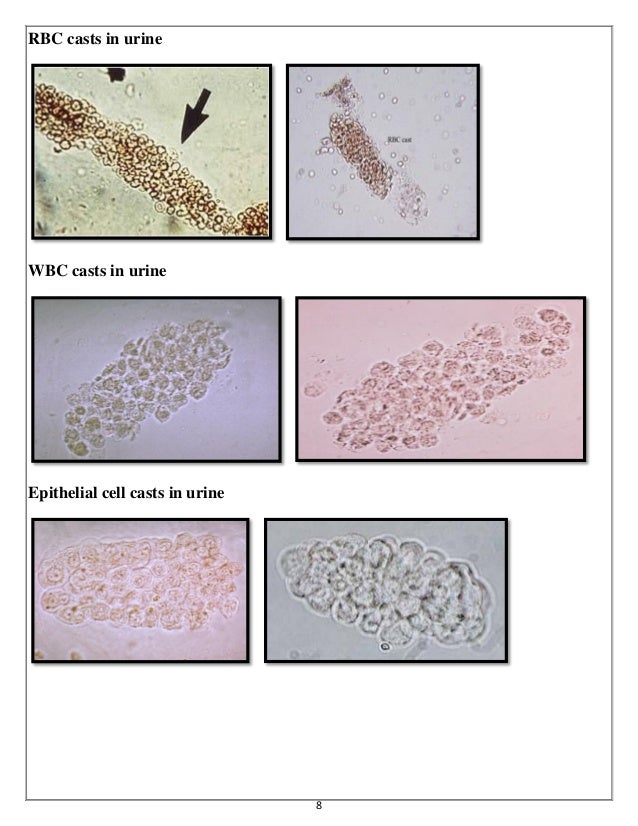 Urine analysis & Hematology Slides