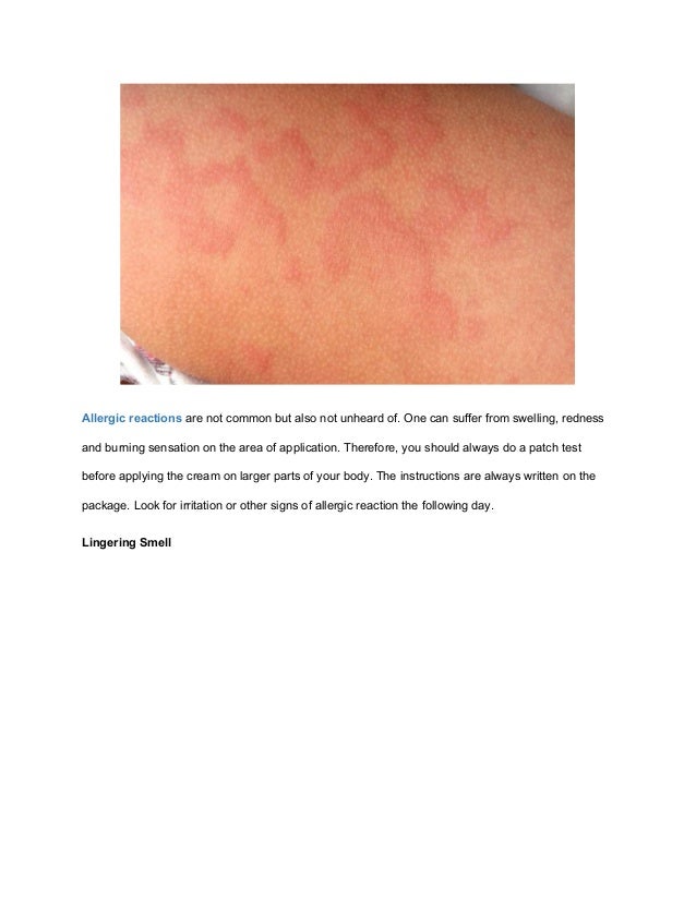 Side effects hair removal creams on skin