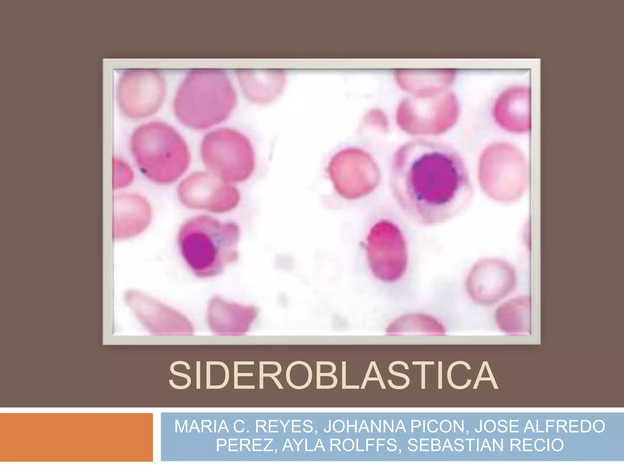 ANEMIA
SIDEROBLASTICA
MARIA C. REYES, JOHANNA PICON, JOSE ALFREDO
    PEREZ, AYLA ROLFFS, SEBASTIAN RECIO
 
