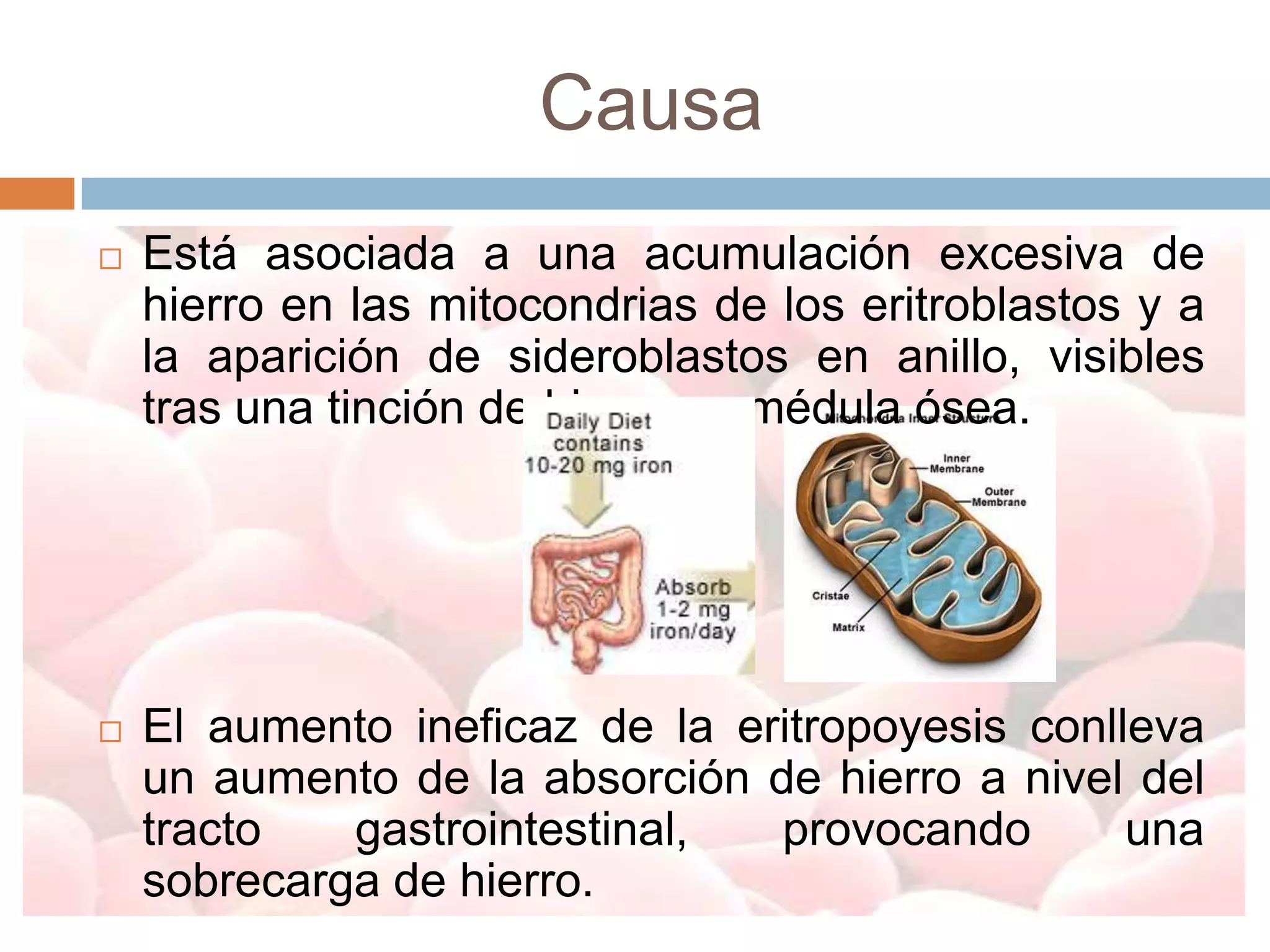 Causa
   Está asociada a una acumulación excesiva de
    hierro en las mitocondrias de los eritroblastos y a
    la aparición de sideroblastos en anillo, visibles
    tras una tinción de hierro en médula ósea.




   El aumento ineficaz de la eritropoyesis conlleva
    un aumento de la absorción de hierro a nivel del
    tracto   gastrointestinal,  provocando       una
    sobrecarga de hierro.
 