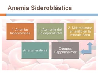 Anemia Sideroblástica
 