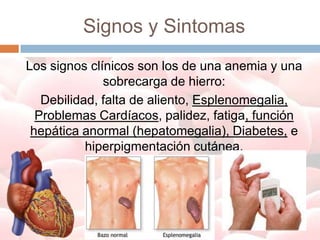 Signos y Sintomas
Los signos clínicos son los de una anemia y una
              sobrecarga de hierro:
   Debilidad, falta de aliento, Esplenomegalia,
  Problemas Cardíacos, palidez, fatiga, función
 hepática anormal (hepatomegalia), Diabetes, e
           hiperpigmentación cutánea.
 