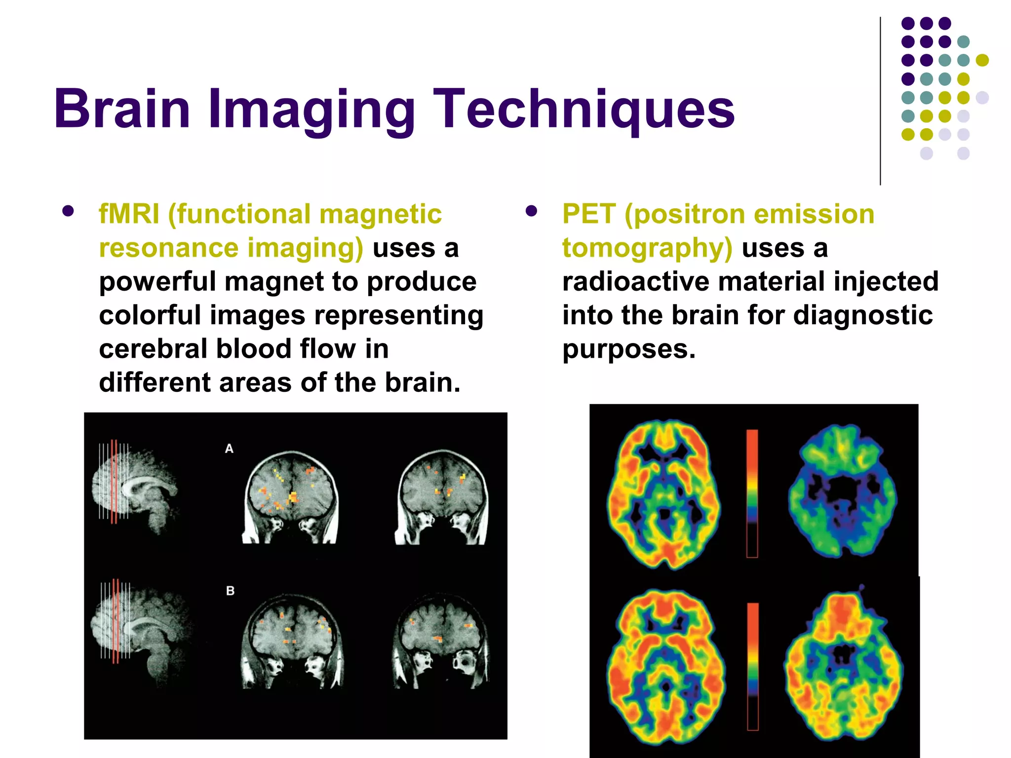 Brain Imaging Techniques
 fMRI (functional magnetic
resonance imaging) uses a
powerful magnet to produce
colorful images representing
cerebral blood flow in
different areas of the brain.
 PET (positron emission
tomography) uses a
radioactive material injected
into the brain for diagnostic
purposes.
 