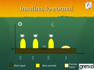 Insulina, lo normal.Insulina, lo normal.

 
  
80

 
Bolo basal Bolo prandial
Periodo
Dawn
 